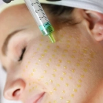 Biorepeel  | Magic on Your Skin 