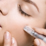 Microneedling + BioRePeel | Magic on Your Skin 