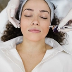 Microneedling  | Magic on Your Skin 
